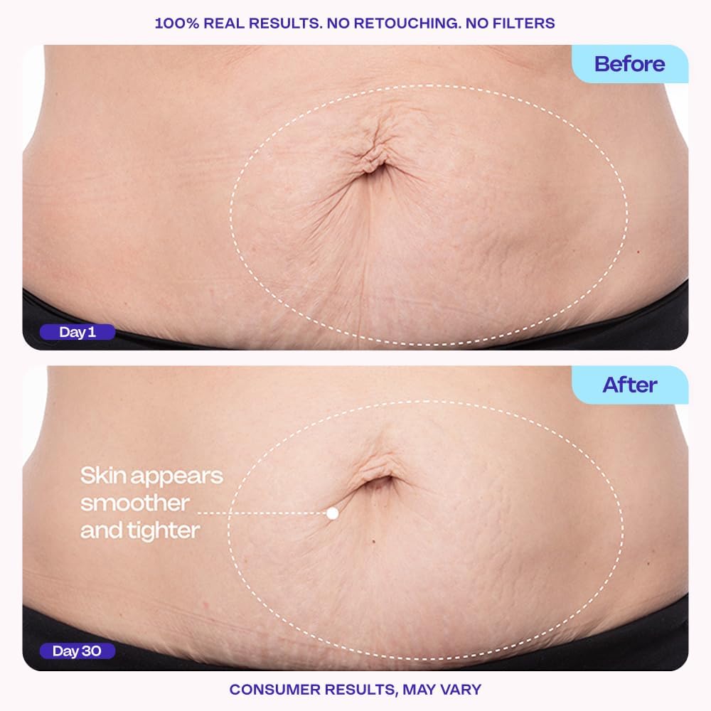 GOPURE Tighten & Smooth Belly Cream